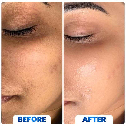 Advanced Brightening & Dark Spot Eraser Cream