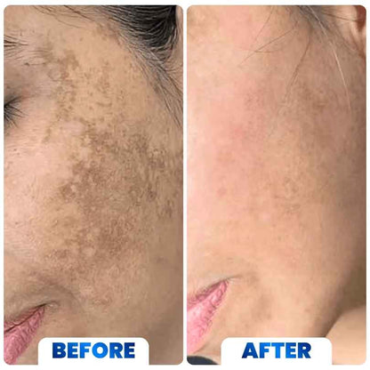 Advanced Brightening & Dark Spot Eraser Cream