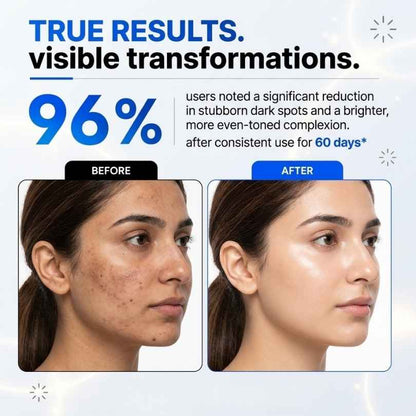 Advanced Brightening & Dark Spot Eraser Cream